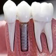 Oral Surgeon